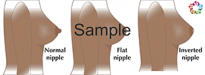 Nipple Shapes Sample