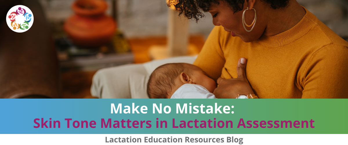 Skin Tones Matter in Lactation