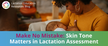 Skin Tones Matter in Lactation