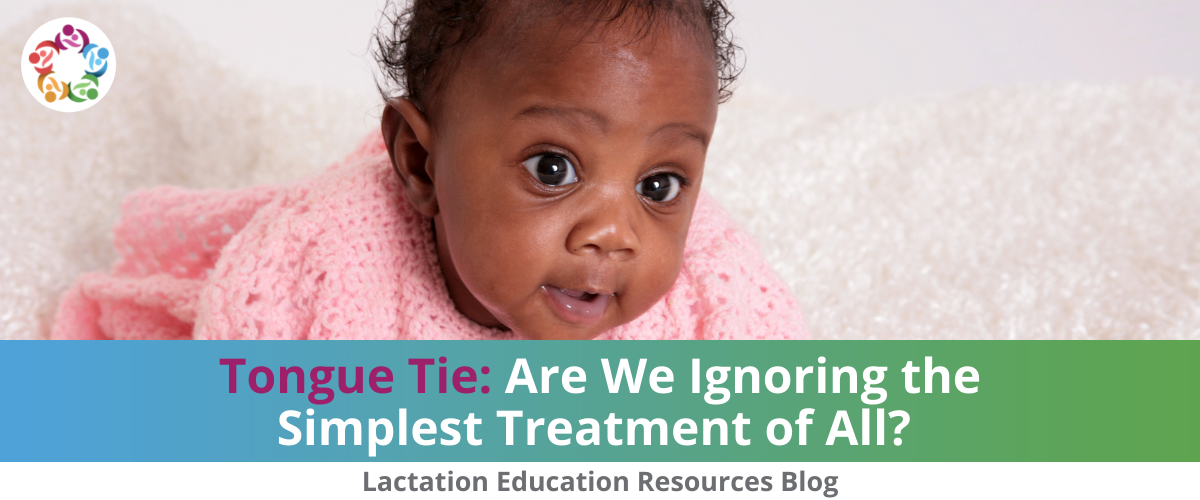 Tongue Tie: Are We Ignoring the Simplest Treatment of All?