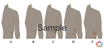 Exterior Breast Growth Sample